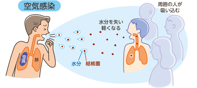 どのように感染するの？